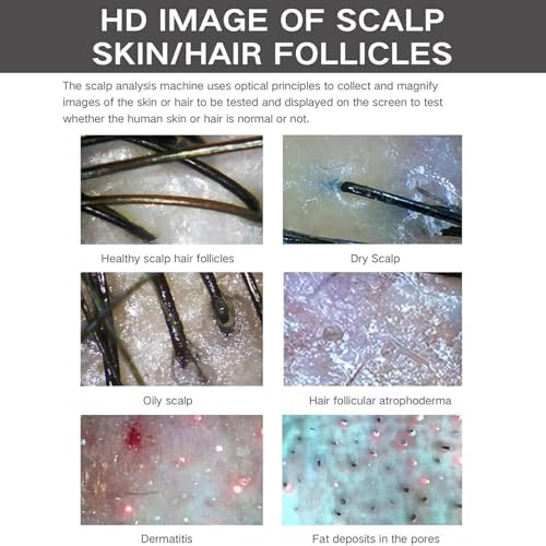 10in Skin Diagnosis Hair Analyzer, Scalp Hair Follicle Detector, with 5 Handles, Hair Analyzer for Home Salon Spa(7in)