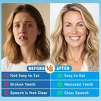 Moldable False Teeth - Silicone Dentures - Men and Veneers Teeth for Women - Upper and Lower Matching Set - Fix Your Smile at Within Minutes - Blue - 1PCS - S77
