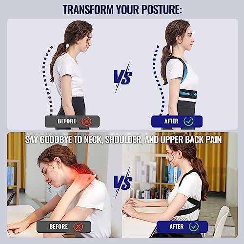 Fit Geno Posture Corrector for Petite Women and Men: Adjustable Upper Back Brace - Improve Posture Correct Hunchback Slouching Invisible Under Clothes (X-Small/Small)