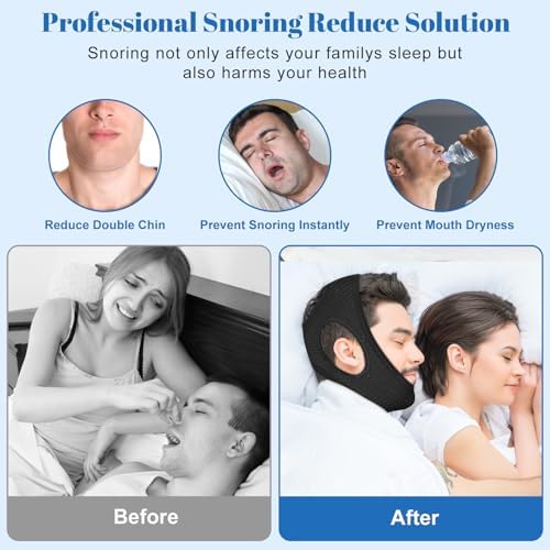 Anti Snore Chin Strap, Chin Strap for Sleeping - Simple and Effective Stop Anti Snoring Devices, Comfortable & Adjustable Snoring Solution, Suitable for Men and Women