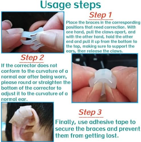 Infant Lop Ear Deformity Correction Clip For Newborn Baby, Fixing Auricle Valgus Patch Stickers Children Ear Shape Aesthetic Corrector Without Surgery