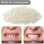 Nuanchu 100g Tooth Repair Kit Moldable Beads for Teeth Replacement Thermal Adhesive Tooth Solid Gel Temporary Fake Teeth Filler for Filling, Fixing, Missing, Broken Halloween Party DIY Cosplay