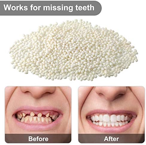Nuanchu 100g Tooth Repair Kit Moldable Beads for Teeth Replacement Thermal Adhesive Tooth Solid Gel Temporary Fake Teeth Filler for Filling, Fixing, Missing, Broken Halloween Party DIY Cosplay