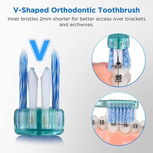Fregum V-Shaped Orthodontic Toothbrush for Braces, Soft Bristles, 6 Count, No Interdental Brushes Included