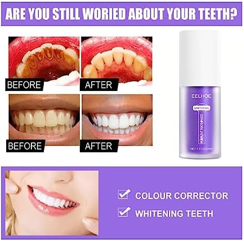 2Pcs Purple Toothpaste for Teeth Whitening, Tooth Stain Removal Smoke Teeth Coffee Colour Corrector.