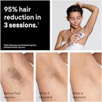 Braun IPL, Silk·Expert Pro 5, IPL Hair Removal for Women and Men, Permanent Laser Hair Reduction At-Home, 1 Head, IPL5100