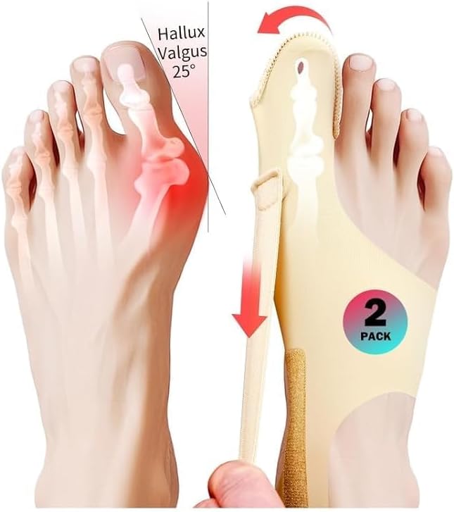2 Pcs Bunion Corrector & Adjustable Toe Spacer for Women & Men-Big Toe Support with Side & Heel Straps, Hallux Valgus Pain Relief, Comfortable for Day & Night. (2, Beige, M)