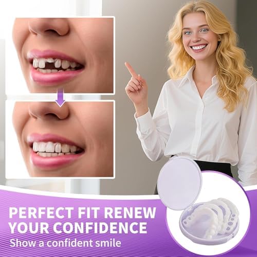 Veneers Teeth for Women and Men, Tooth Replacement Kit, Nature and Comfortable (1 Count (Pack of 1))-AAZ8