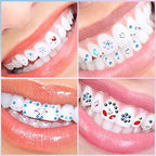 Sosation 377 Pieces Tooth Gem Kit for Women DIY Fashionable Tooth Jewelry Kit Artificial Crystal Reflective Teeth Gems Starter Set Gift for Christmas Teeth Party Decorations Bright Style