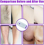Valentines Day Gifts for Her Focusing Silky Smooth Hair Eraser, Portable Painless Hair Removal Tool, Rechargeable Epilator Smooth Touch Hair Remover, Applicable to Any Part of The Body Gift for Women