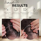 Fiora Naturals Scalp Massager Shampoo Brush - Silicon Scalp Scrubber & Exfoliator for Dandruff Removal and Hair Growth, Scalp Brush for Wet & Dry Hair, Shampoo Brush for Men, Women, Kids - BPA Free
