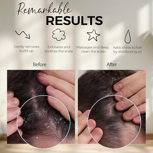 Fiora Naturals Scalp Massager Shampoo Brush - Silicon Scalp Scrubber & Exfoliator for Dandruff Removal and Hair Growth, Scalp Brush for Wet & Dry Hair, Shampoo Brush for Men, Women, Kids - BPA Free