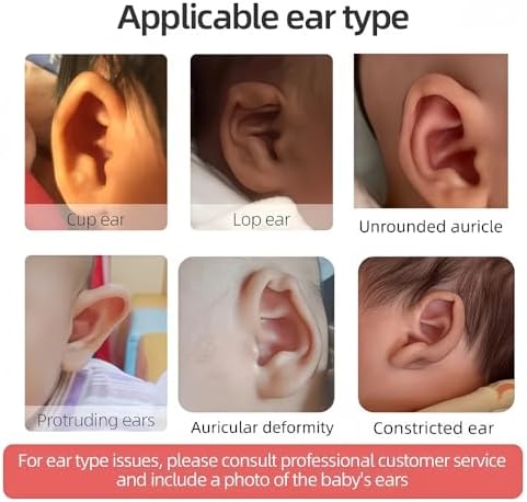 4cmx100cm Newborn ( 0 to 6 months ) Auricle Valgus Deformity Correction Patch, Baby Ear Aesthetic Silicone Gel Tape for Cup Ear, Lop Ear, Stick Out Ear, Prominent Rar, Infant Protruding Ear Stickers