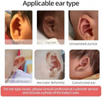 4cmx100cm Newborn ( 0 to 6 months ) Auricle Valgus Deformity Correction Patch, Baby Ear Aesthetic Silicone Gel Tape for Cup Ear, Lop Ear, Stick Out Ear, Prominent Rar, Infant Protruding Ear Stickers