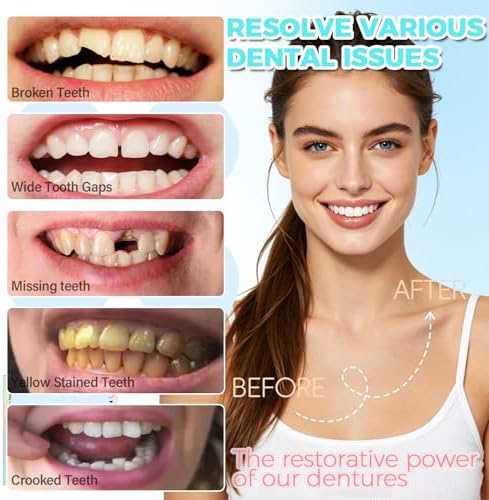 Temporary Dentures for Women and Men - Moldable Silicone False Teeth, Upper & Lower Veneers Set for At-Home Smile Fix (Natural)