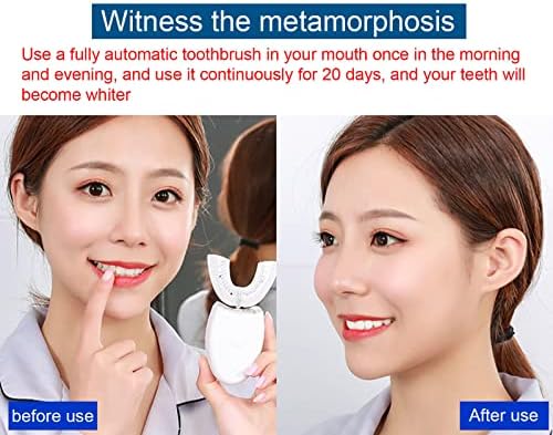 Electric Toothbrush Adults - U-Shaped Toothbrushes for Teeth Whitening - 360° Mouth Cleansing Hands Free Gums Protection Waterproof,D