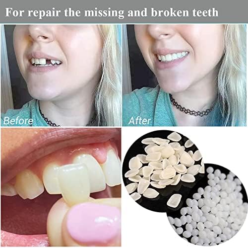 Tooth Repair Kit for Fixing the Missing Chipped and Broken Tooth Gap Temporary Replacement Thermal Beads and Fake Teeth Brace Mold