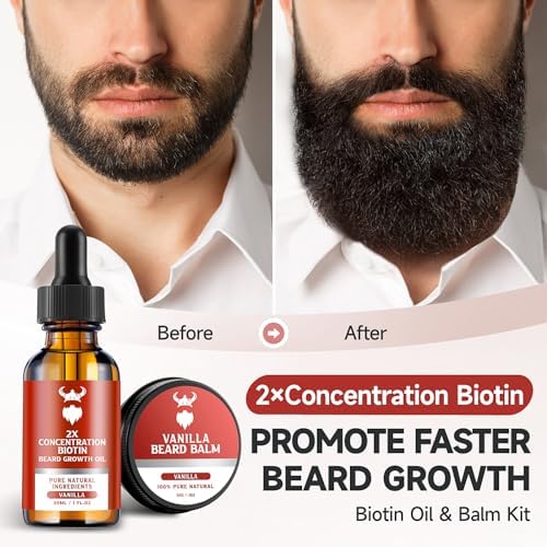 MistySprite Beard Growth Kit - 2X Concentration Biotin for Men, Natural Ingredients with Argan Oil, Jojoba Oil and Vitamin (Vanilla)