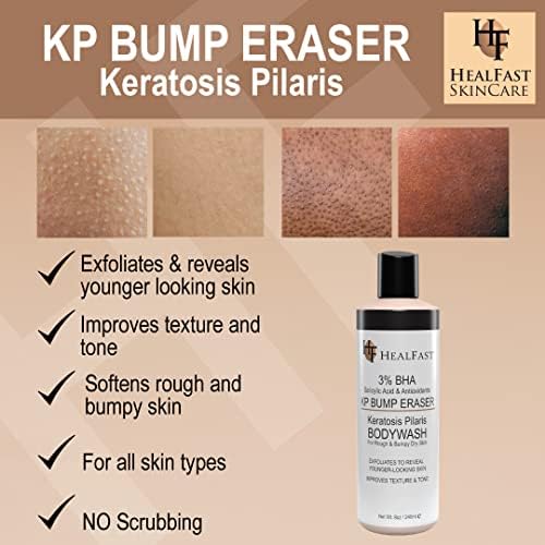 HealFast KP Bump Eraser Bodywash – Soften, Exfoliate, Nourish Rough and Bumpy Skin with 3% BHA – Keratosis Pilaris - For All Types – No Scrubbing Required – Fragrance and Paraben Free