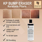 HealFast KP Bump Eraser Bodywash – Soften, Exfoliate, Nourish Rough and Bumpy Skin with 3% BHA – Keratosis Pilaris - For All Types – No Scrubbing Required – Fragrance and Paraben Free