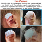Infant Lop Ear Deformity Correction Clip For Newborn Baby, Fixing Auricle Valgus Patch Stickers Children Ear Shape Aesthetic Corrector Without Surgery