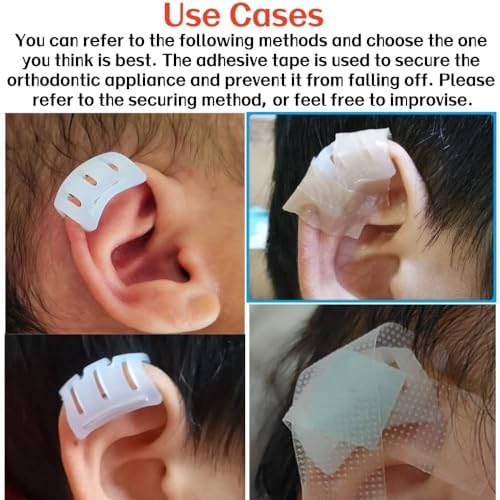 Infant Lop Ear Deformity Correction Clip For Newborn Baby, Fixing Auricle Valgus Patch Stickers Children Ear Shape Aesthetic Corrector Without Surgery