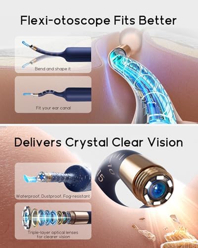 Bebird Earsight Plus R37R Ear Cleaning Camera Wax Removal Tool kit, FSA HSA Eligible Flexible Ear Scope Otoscope Camera Light, Visual Ear Picker Wireless Earwax Remover Tweezers for Adults & Kids