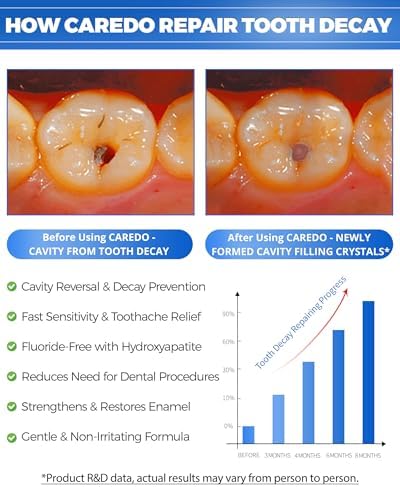 CAREDO Cavity Reversal Hydroxyapatite Toothpaste for Adults, Cavity Tooth Filler as Home Cavity Repair, Fluoride Free Reverse Cavities Treatment for Tooth Decay Repair, Remineralizing Repair 3.52OZ