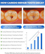 CAREDO Cavity Reversal Hydroxyapatite Toothpaste for Adults, Cavity Tooth Filler as Home Cavity Repair, Fluoride Free Reverse Cavities Treatment for Tooth Decay Repair, Remineralizing Repair 3.52OZ