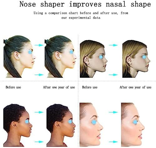 Nose Shaper Lifter Clip - Reshape & Straighten Wide Noses for Men & Women