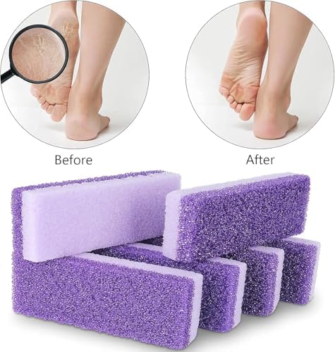 2 PCS Foot Pumice Stone Pedicure Stone Double Sided Pedicure Foot Pumice Stone Feet Pumice Sponge Feet Callus Remover and Scrubber for Feet and Heels Callus and Dead Skins(Purple)