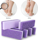 2 PCS Foot Pumice Stone Pedicure Stone Double Sided Pedicure Foot Pumice Stone Feet Pumice Sponge Feet Callus Remover and Scrubber for Feet and Heels Callus and Dead Skins(Purple)