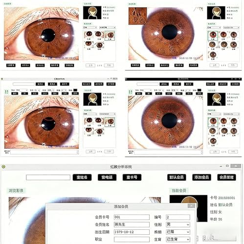 Iris Analysis Camera, 5.0 MP USB Iris Analyzer Iridology Camera, with HD 30x Iris Lens and Driver-Free Analysis Software Eye Iridology Camera for Beauty Salons