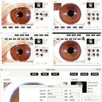 Iridology Camera Analyzer, 5.0 Mp USB Iriscope Iris Analyzer Iridology Camera, Eye Iridology Camera, HD 30x Iris Lens and Driver-Free Analysis Software