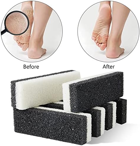 2 in 1 Pumice Stone for Feet,6 Pack Foot Scrubber & Callus Remover, Stone Scrubber for Hard Skin,Foot Pumice,Dead Skin Remover for Feet, Heels, Hands and Body