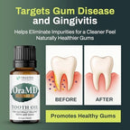 OraMD 4-in-1 Original Strength Tooth Oil- Clinically Tested Gum Disease Treatment, Gingivitis Treatment, Periodontal Disease Treatment, Sensitive Teeth and Gums - All-Natural Solution (1-Pack)