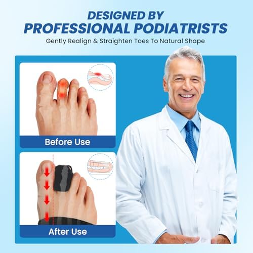Hammer Toe Straightener - Hammer Toe Corrector for Women & Men, Breathable Non-Slip Toe Splint for Curled, Crooked Toes, Broken Toe Support - Day & Night Relief (1 Compression Foot Wrap & 1 Strap)