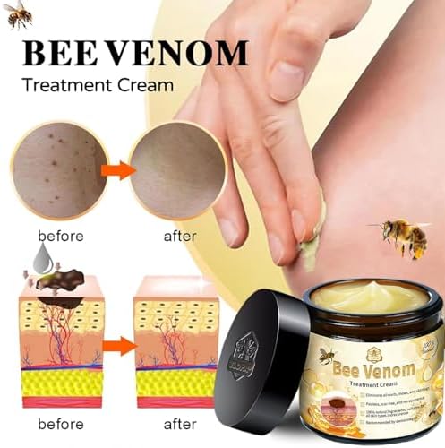 Bee Venom Skin Treatment Cream, 2024 New Bee Venom Repair Cream, Professional Bee Venom Cream-30g, Repair Maximum Strength for All Skin Types (1 Bottle)