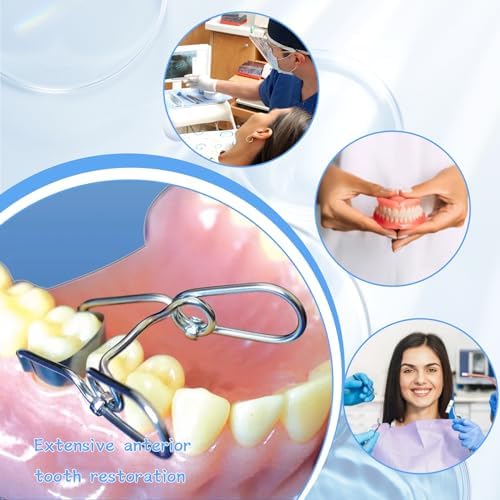 30 Piece Dental Anterior Matrix Kit with Proximal Strips and Twin Anterior Matrices - 0.035mm Thickness Soft Stainless Steel Bands Double-Side Sectional Contoured Design for Front Teeth Restorations