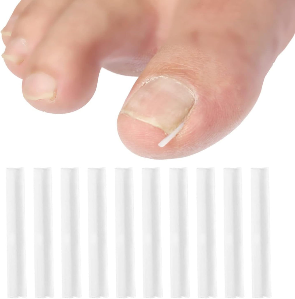 10Pcs White Ingrown Toenail Correction Strips Brace Kit, Ingrown Toenail Corrector Straightener Strips Recover Toenails Thick Pedicure Tool Toenail Straightener Strip for Men Women Foot Care Tool