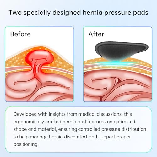 Hernia Belt for Men - Adjustable Support Brace, Comfortable & Breathable Design, Ideal for Single/Double Inguinal Hernia Pain Relief, Discreet Wear for Everyday Use (Black, Medium)