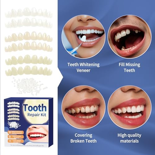 Tooth Repair Kit，Temporary Natural Shade for Filling The Gap, Moldable Thermal Beads Replacement Kit Replace The Missing or Broken Tooth-6PCS-R01