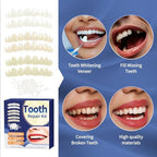 Tooth Repair Kit，Temporary Natural Shade for Filling The Gap, Moldable Thermal Beads Replacement Kit Replace The Missing or Broken Tooth-6PCS-R01
