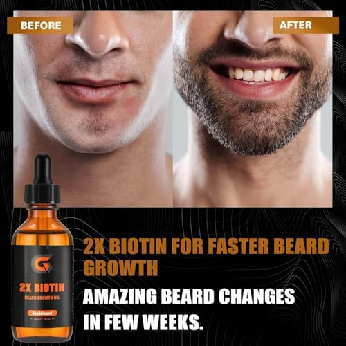 2X Biotin Beard Growth Oil for Men - Natural Organic Leave-in Conditioner & Softener - Mustache & Facial Hair Thickener, Moisturizer & Strengthener - Anti Itch & Dandruff Serum, 2 fl.Oz (Sanda)
