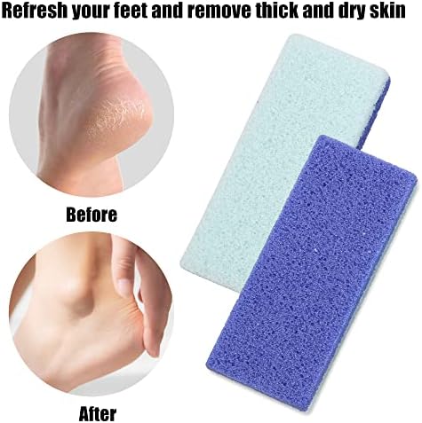 VOCOSTE 4 Pcs Foot Care Exfoliating Scrub Stone, Double Sided Fine and Coarse Pumice Stone, Foot File, Blue