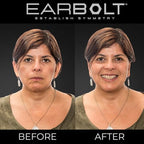 EARBOLT - Ear Pinning Adhesives | Cosmetic Ear Correctors, Pack of 20
