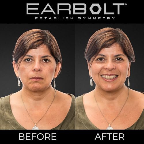 EARBOLT - Ear Pinning Adhesives | Cosmetic Ear Correctors, Pack of 20