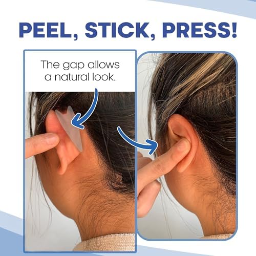 EarPro Cosmetic Ear Corrector – Stronger Adhesive Stickers, Hold Back Protruding Ears Without Surgery – Invisible, Water-Resistant Patches for Adults to Correct Ear Position – 20 Pack – Clear One Size