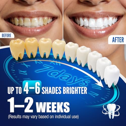 Teeth Whitening Pen Kit - 35% Carbamide Peroxide, Stain Removal, 4 Whitening Pens + 2 Remineralizing Pens, Enamel Repair, Anti-Cavity, Sensitive Teeth Care, 6 x 0.14 fl oz (Spearmint)