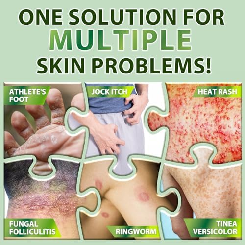 Antifungal Cream with Tea Tree Oil – Advanced Herbal Relief for Skin Fungus, Jock Itch, Eczema, Athlete's Foot, Tinea Versicolor, Natural Treatment – 100g